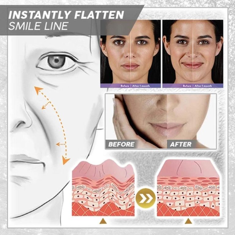 AntiAging™ Entfernt Falten in nur 1 Woche!