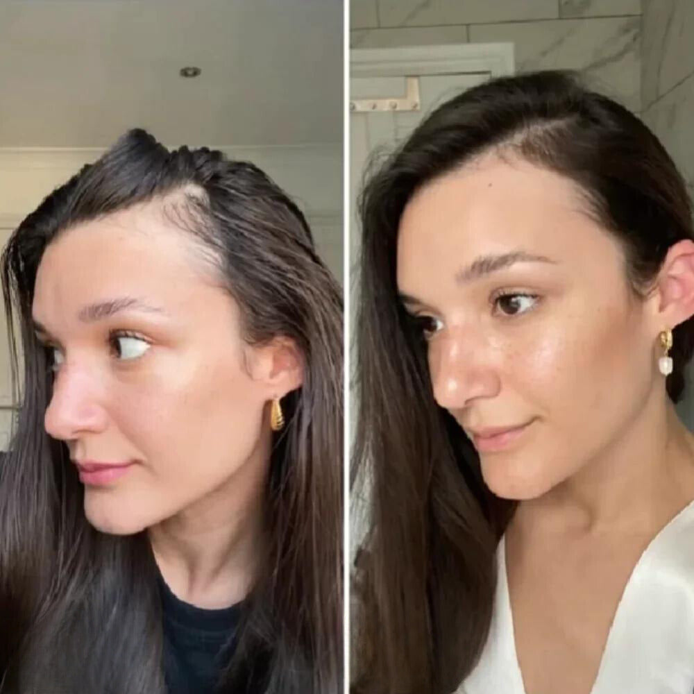 VitalGrowth™ Haarwuchsöl