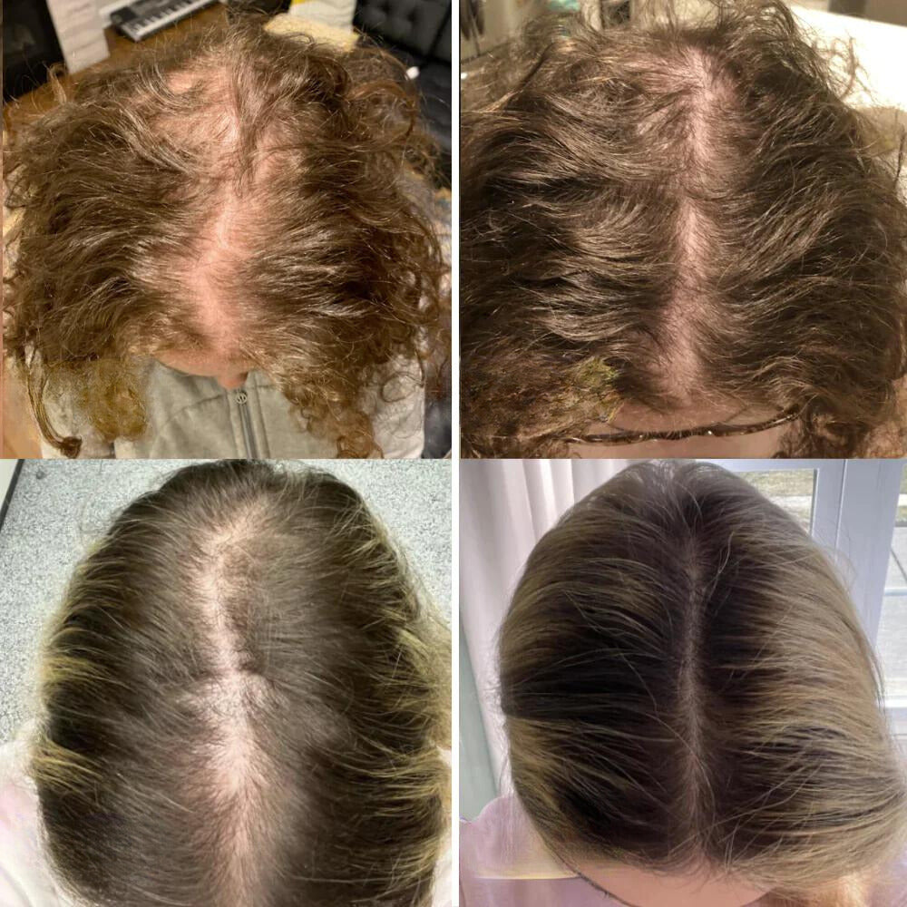 VitalGrowth™ Haarwuchsöl