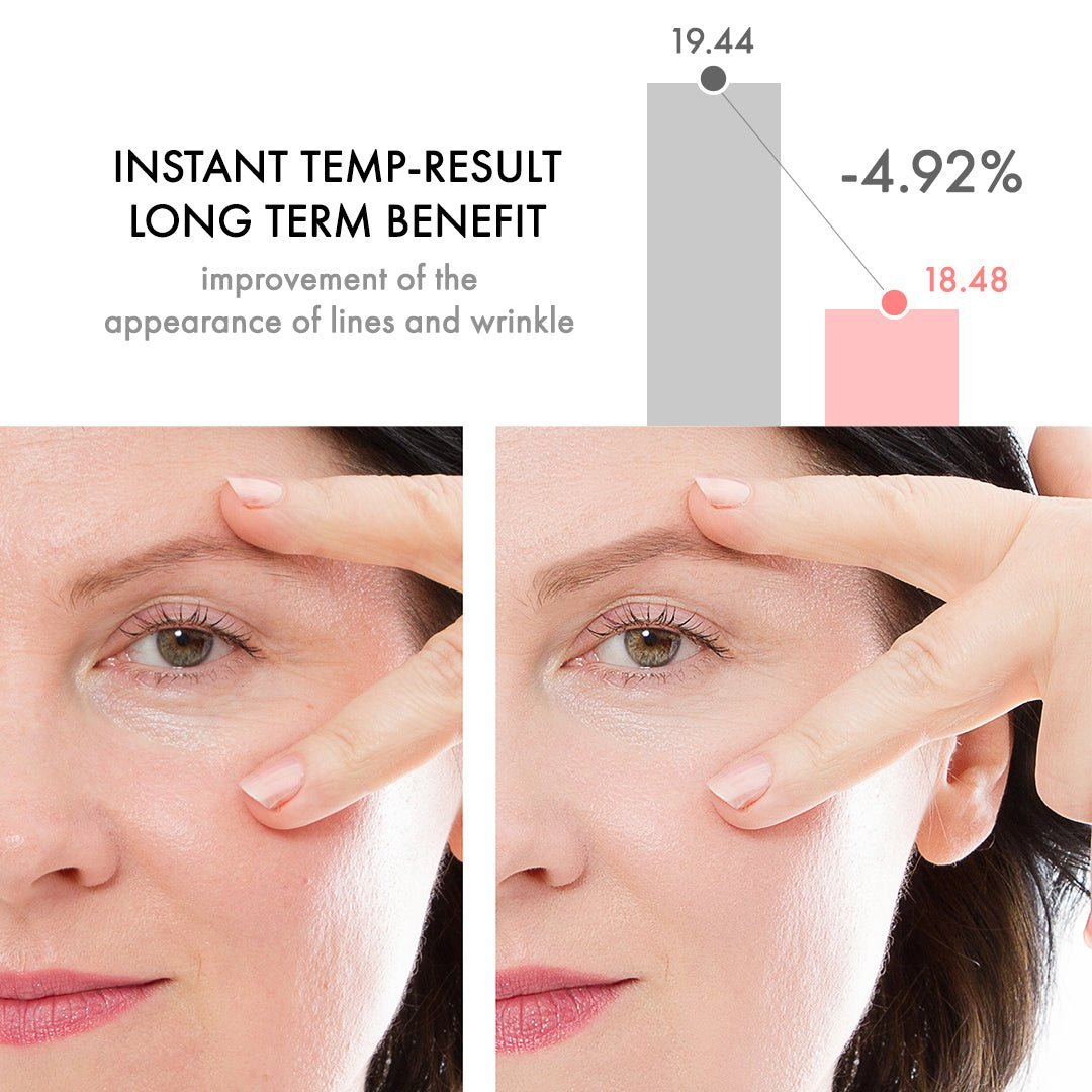 WrinkleAway™ reduziert Fältchen