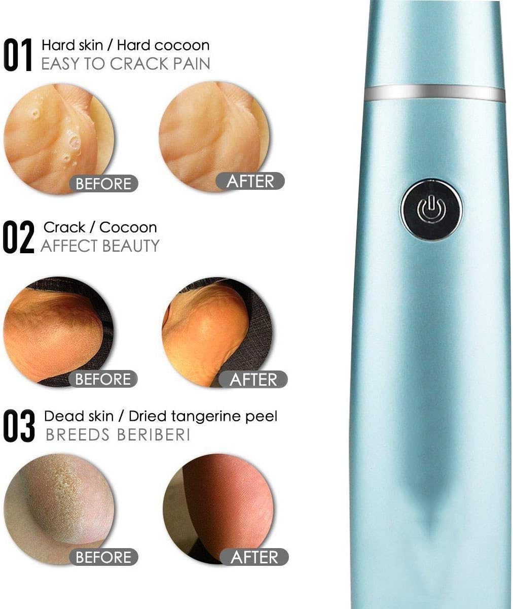 SilkaFeet™ | Mühelos glatte und gepflegte Füße