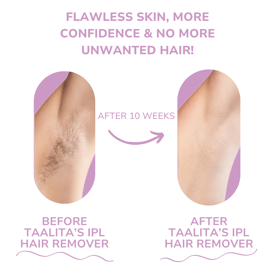 SmoothTouch™ Glatte Haut schnell