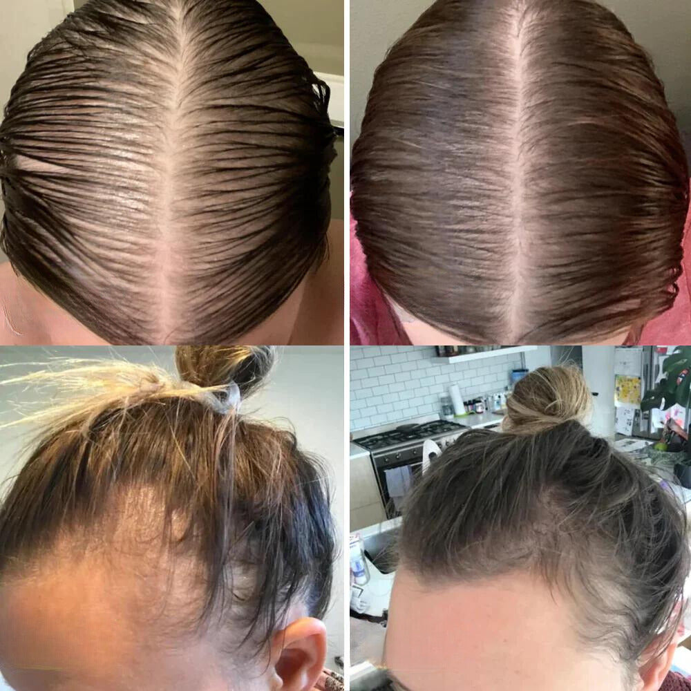 VitalGrowth™ Haarwuchsöl